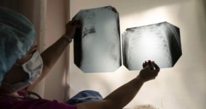 ΚΟΡΩΝΟΪΌΣ: Συγκλονίζει πνευμονολόγος του Γενικού Νοσοκομείου Λευκωσίας