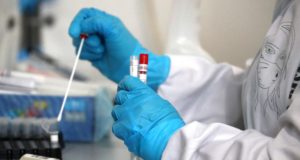 Αλλάζουν τα κριτήρια πραγματοποίησης PCR κατά την άφιξη στα αεροδρόμια