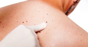 Επιτακτική ανάγκη ο έλεγχος των ελιών μετά το Καλοκαίρι