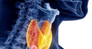 Βρείτε το νωρίς – Ενημέρωση για τον καρκίνο του θυρεοειδούς αδένα από τον ΠΑΣΥΚΑΦ