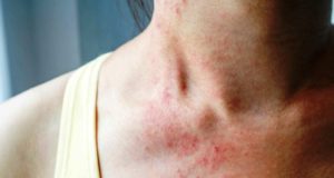 Αλλεργιογόνες Ουσίες: Η κρυμμένη απειλή στα τρόφιμα και πώς να προστατέψετε τον οργανισμό σας