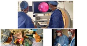 Πρωτοποριακά χειρουργεία αυξάνουν το προσδόκιμο επιβίωσης για κακοήθεις όγκους εγκεφάλου και σπονδυλικής στήλης