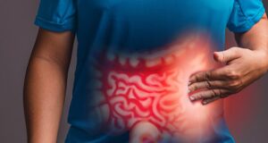 Τι είναι η νόσος του Crohn που ανιχνεύτηκε πριν 83 χρόνια