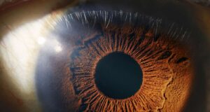 Αυτό το σημάδι στο πίσω μέρος των ματιών μπορεί να υποδηλώνει άνοια;