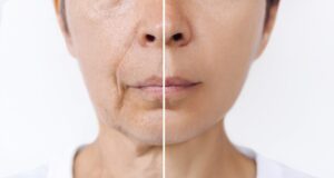 Φαίνεστε μικρότεροι από την ηλικία σας; Τι σημαίνει αυτό για την υγεία σας