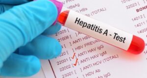 Ηπατίτιδα Α: Σημαντική αύξηση κρουσμάτων σε 4 ευρωπαϊκές χώρες