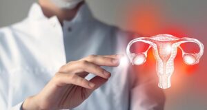 Πρόπτωση γυναικολογικών οργάνων: Τι είναι και πώς αντιμετωπίζεται