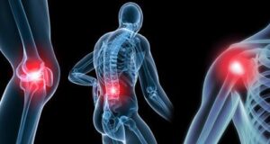 Οστεοαρθρίτιδα: Επικίνδυνα και για το γόνατο τα υπερεπεξεργασμένα τρόφιμα